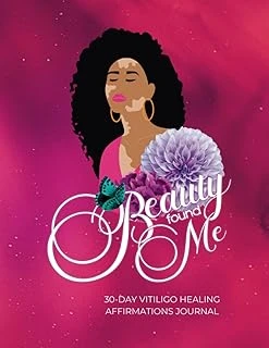 Independently Published Vitiligo Book Affirmation Journal For Black Women - Beauty Found Me - A Positive Journal For Women For Healing, Self-Esteem, Self-Care Journey For Vitiligo Diagnosis ürün görseli 1