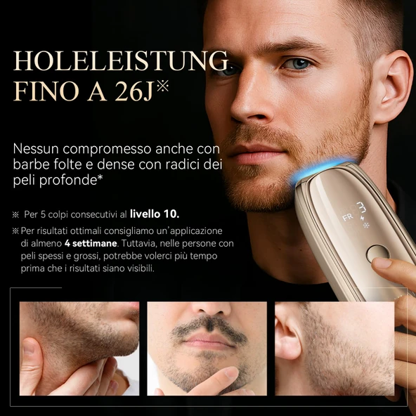 ANLAN Lazer Epilasyon 26Y - Resim 5