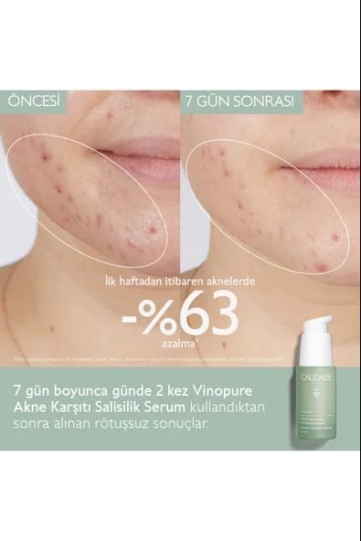 Caudalie Vinopure Serum 30 ml - Resim 6