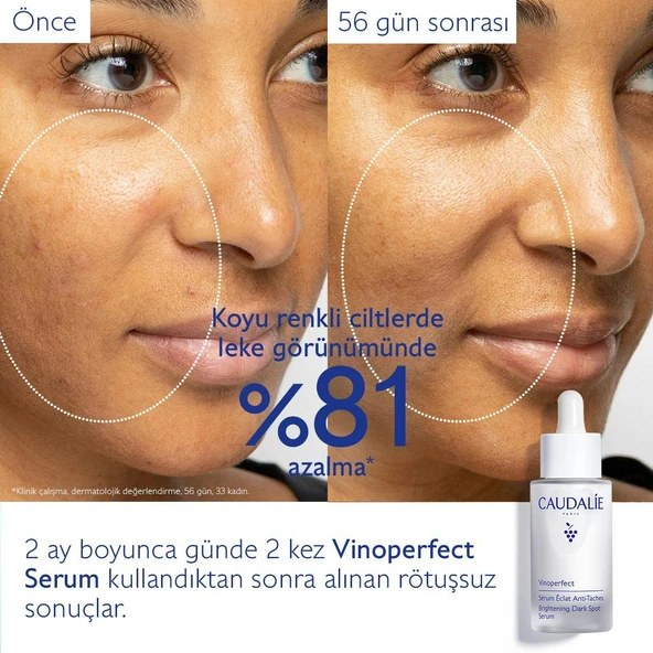 Caudalie Vinoperfect Radiance Serum Complexion Cor 50 ml - Resim 4
