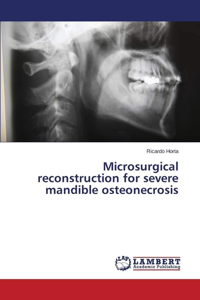 Microsurgical Reconstruction For Severe Mandible Osteonecrosis ürün görseli 1