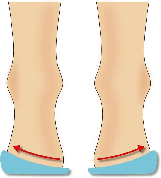 Icemen 505 Silikon Topukluk, İçe Dışa Basma Düzeltici, 4 Beden (Xs-L),%100 Silikon Yapı (S (34-37)) ürün görseli 1