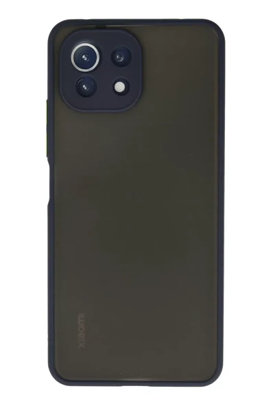 Newface Xiaomi Mİ 11 Lite Kılıf Montreal Silikon Kapak - Lacivert ürün görseli 1
