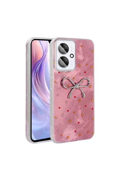 Xiaomi C65 Kılıf Kamera Korumalı Figürlü Zore Ponti Silikon Kapak ürün görseli 1