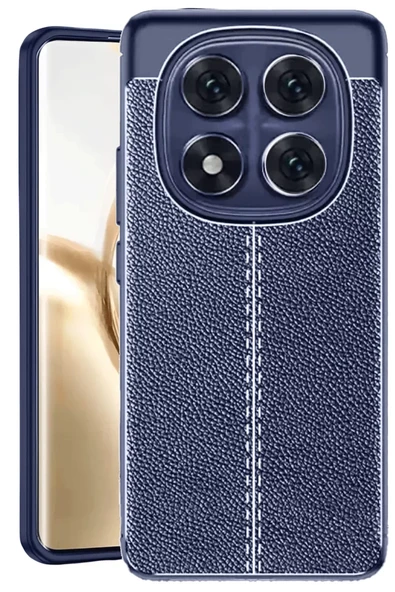 Newface Xiaomi Redmi Note 14 Pro 4G Kılıf Auto Focus Kapak - Lacivert ürün görseli 1