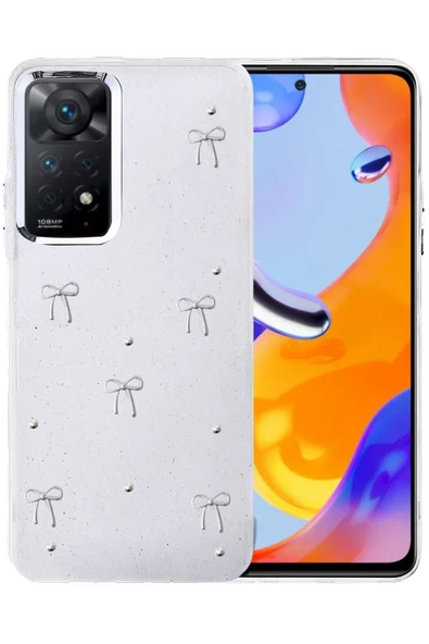 Newface Xiaomi Redmi Note 11 Pro Fiyonk Desenli Kapak - Desen 5 ürün görseli 1