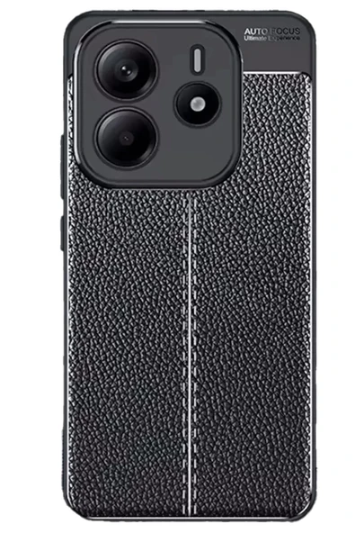 Newface Xiaomi Redmi Note 14 4G Kılıf Auto Focus Kapak - Siyah ürün görseli 1