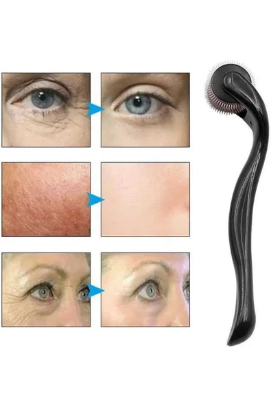 Dermaroller Titanyum 540 Iğneli 1 Mm Saç Kaş Sakal Serum Kullanıma Uygun ürün görseli 1