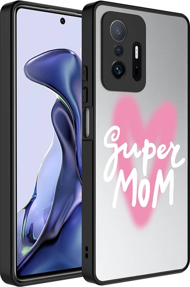 Xiaomi Mi 11T 5g Kılıf Aynalı Desenli Kamera Korumalı Parlak Mnc Mirror Kapak-Süper Anne ürün görseli 1