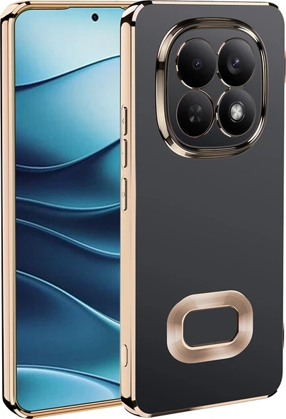 Rengareng Redmi Note 15 Pro 4g Kılıf Kamera Korumalı Logo Gösteren Zore Omega Kapak - Gold ürün görseli 1