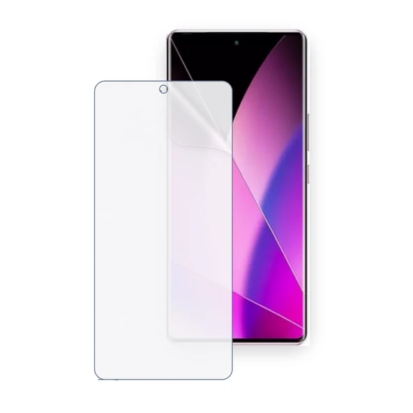 SChitec Infinix Zero 40 Uyumlu Hidrojel Ekran Koruyucu ürün görseli 1
