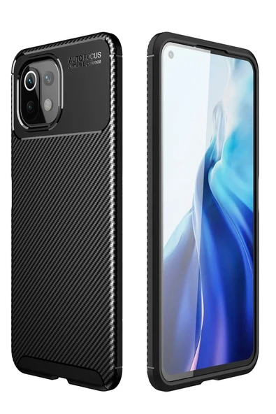 Newface Xiaomi Mİ 11 Lite Kılıf Auto Focus Karbon Kapak - Siyah ürün görseli 1
