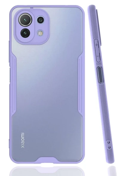 Newface Xiaomi Mİ 11 Lite Kılıf Platin Silikon - Lila ürün görseli 1