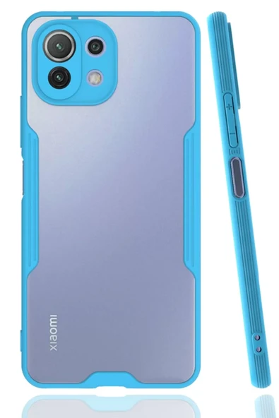 Newface Xiaomi Mİ 11 Lite Kılıf Platin Silikon - Mavi ürün görseli 1