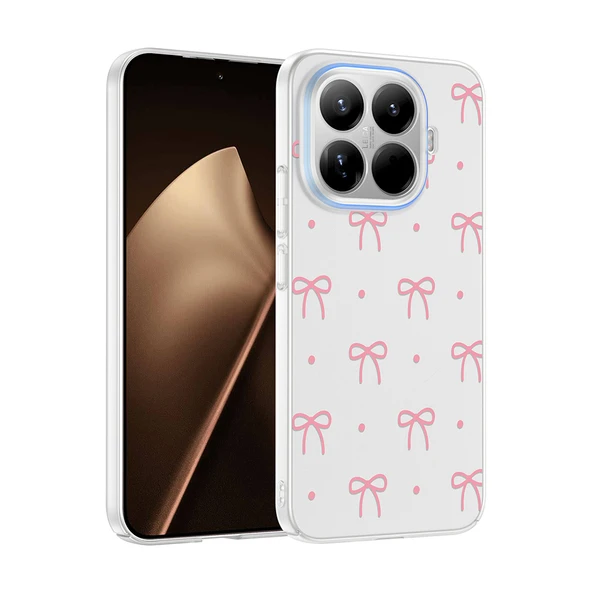 Xiaomi 15T Pro Kılıf Kamera Korumalı Canlı Lüx Desenli Klip Sert Kapak ürün görseli 1
