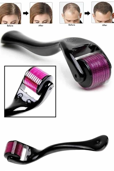 Derma Roller Titanyum Uçlu 540 İğneli 1 Mm Saç Sakal Çıkarma Ve Cilt Bakım Masaj Aleti ürün görseli 1