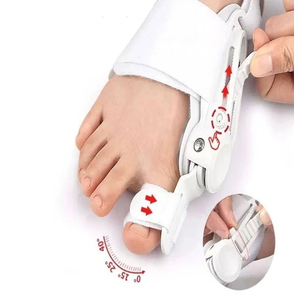 Ayarlanabilir Ayak Baş Parmak Kemik Düzeltici – Halluks Valgus (Bunyon) Aparatı, Gece Gündüz Kullanıma Uygun Ayak Düzeltme Ateli ürün görseli 1