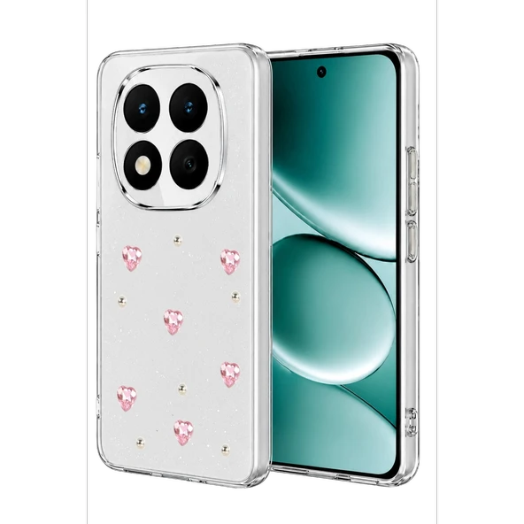 Xiaomi Redmi Note 15 Pro 4G Fiyonk Desenli Kapak - Desen 3 ürün görseli 1
