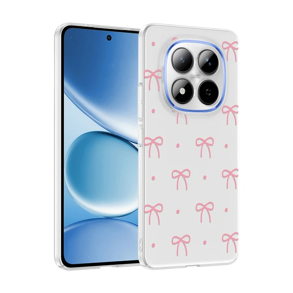 Xiaomi Redmi Note 15 Pro Kılıf Kamera Korumalı Canlı Lüx Desenli Klip Sert Kapak ürün görseli 1