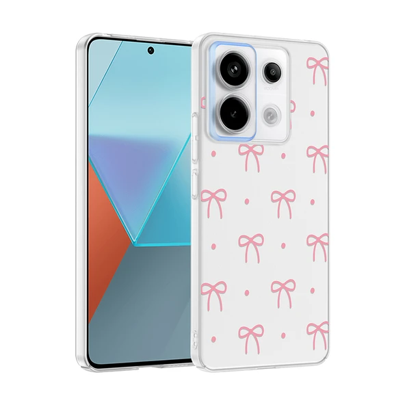 Xiaomi Redmi Note 13 Pro 5G Kılıf Kamera Korumalı Canlı Lüx Desenli Klip Sert Kapak ürün görseli 1
