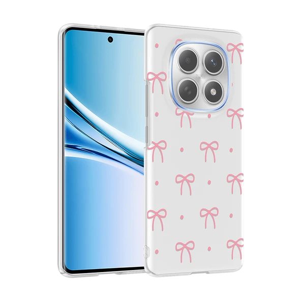 Xiaomi Redmi Note 15 4G Kılıf Kamera Korumalı Canlı Lüx Desenli Klip Sert Kapak ürün görseli 1