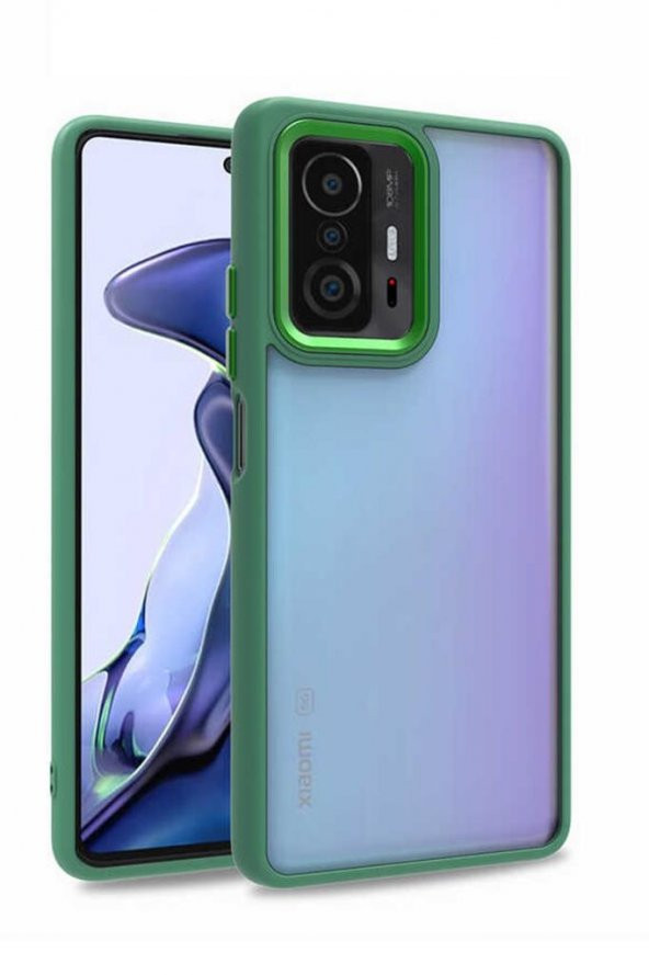 Xiaomi Mi 11T Pro 5G Kılıf Kamera Korumalı Mat Renkli Silikon ürün görseli 1