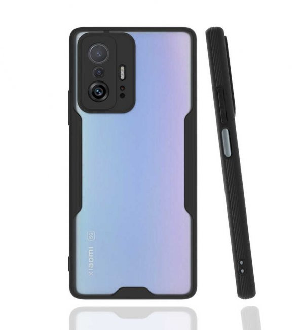 Xiaomi Mi 11T Pro Kılıf Platin Kamera Korumalı Silikon Kılıf ürün görseli 1