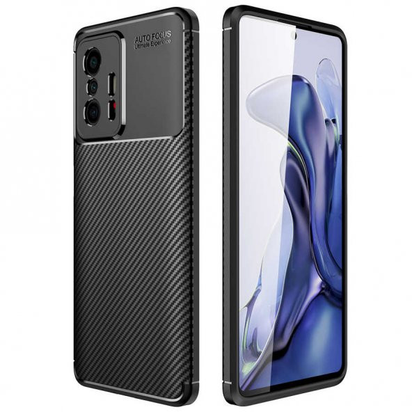 Xiaomi Mi 11T 5G Kılıf Focus Karbon Kamera Korumalı Kılıf ürün görseli 1