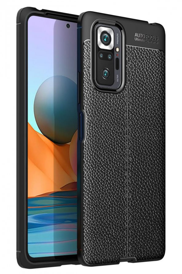 Xiaomi Redmi Note 10 Pro Kılıf Focus Derili Silikon Kılıf ürün görseli 1