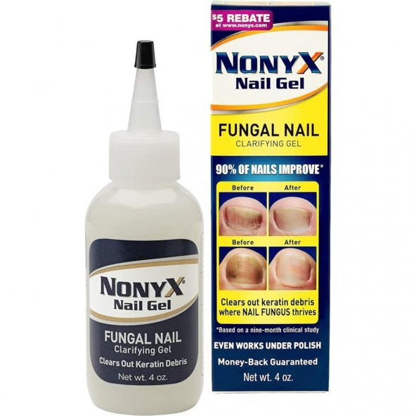 Nonyx Nail Gel 113GR ürün görseli 1