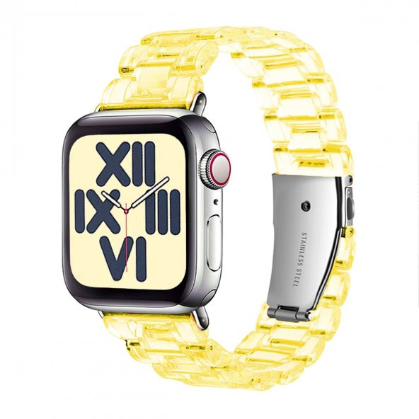 E2M Apple Watch 38-40mm KRD-22 Candy Sarı Kordon - Resim 2