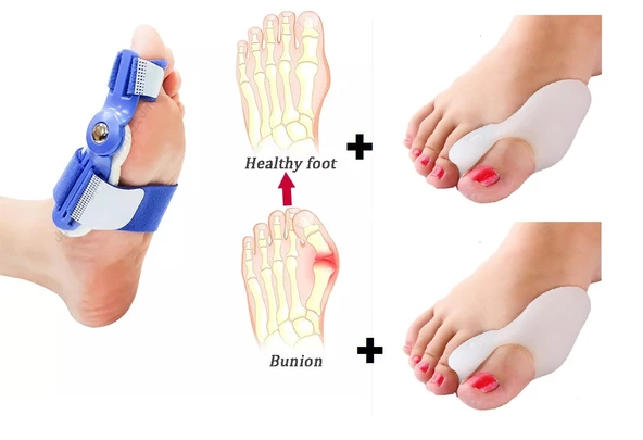HALLUKS  VALGUS GECE ATELİ MAVİ 2 adet  SİLİKON BUNYON SETİ 2 adet ürün görseli 1