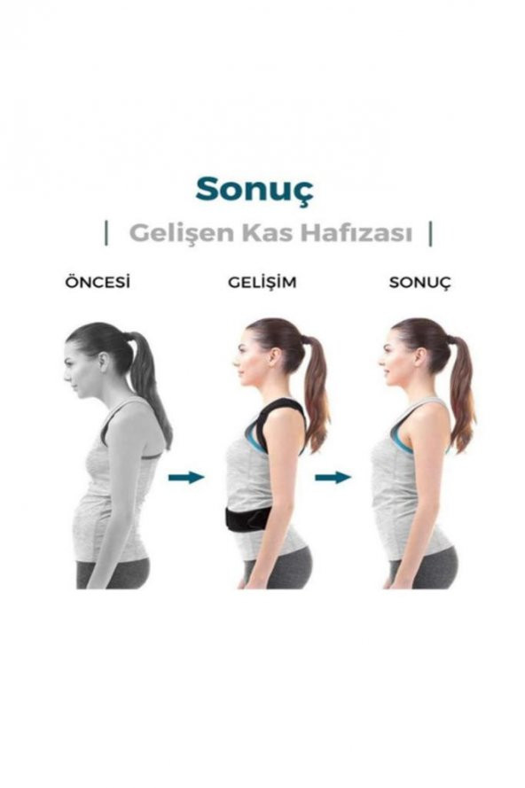 Ortopedik Kamburluk Önleyici Balenli Manyetik Unisex Dik Duruş Korsesi ürün görseli 1