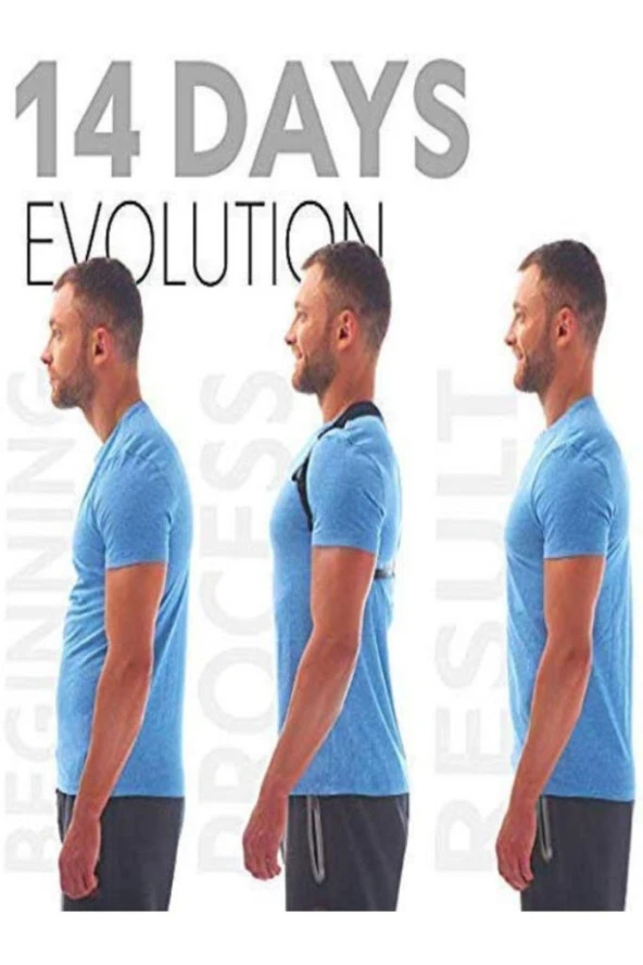 Yeni Nesil Dik Duruş Kamburluk Önleyici Unisex Korse, ürün görseli 1