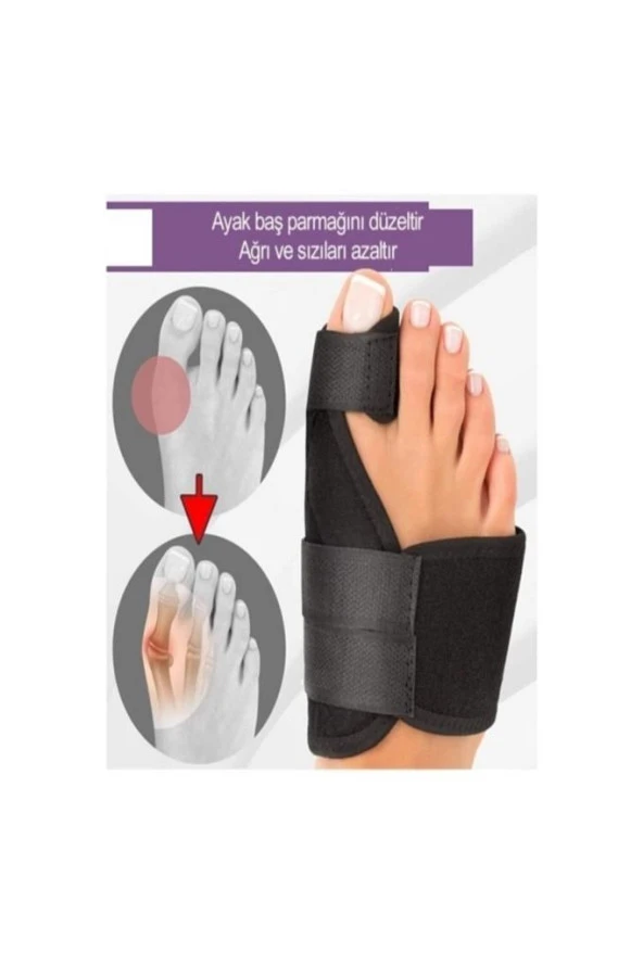 Newconcept Halluks Valgus Gece Ateli Ayak Bunyon Kemik Koruyucu 1 Çift (sağ Ve Sol) ürün görseli 1