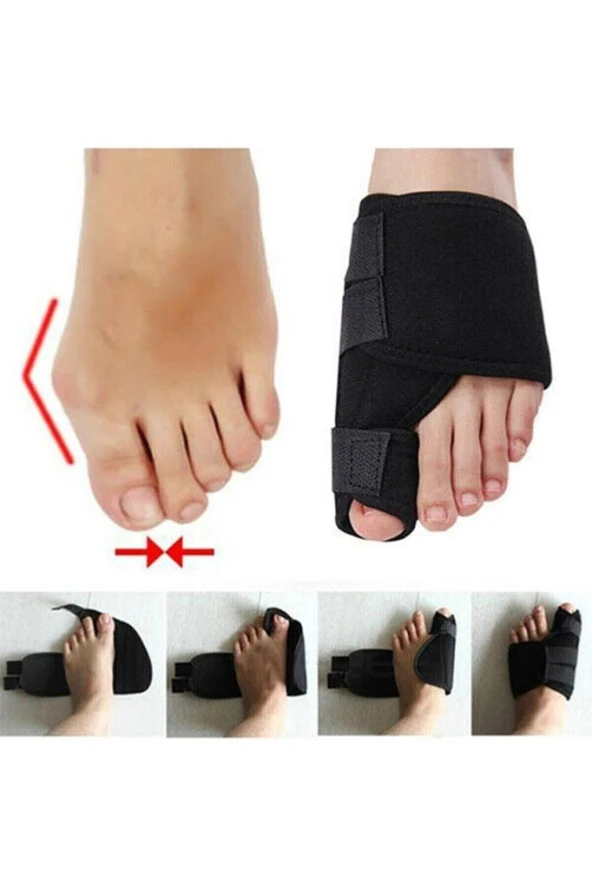 Supportline 2 Adet Halluks Valgus Gece Ateli Halluks ürün görseli 1