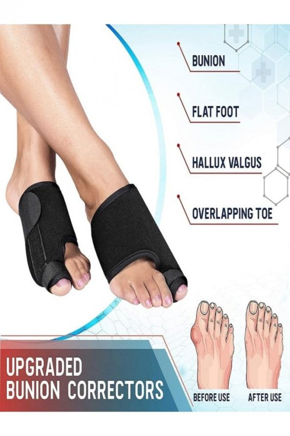 Halluks Valgus Gece Ateli Ayak Bunyon Kemik Koruyucu 1 Çift (sağ Ve Sol) ürün görseli 1