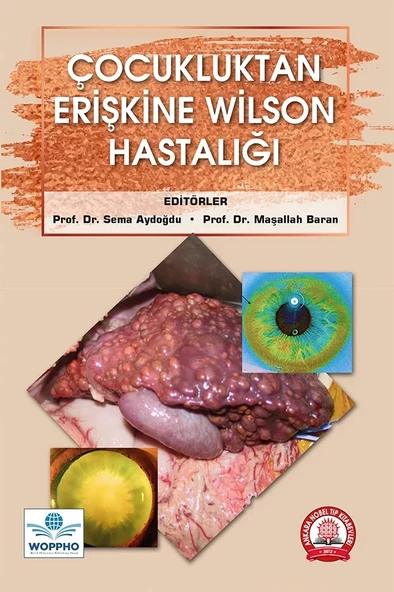 Çocukluktan Erişkine Wilson Hastalığı ürün görseli 1