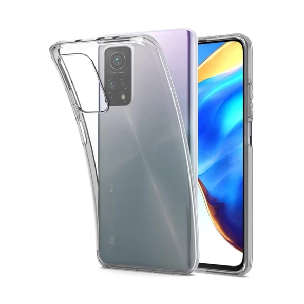 Smcase Xiaomi Mi10T Pro Kılıf Lüks Tpu Silikon ürün görseli 1