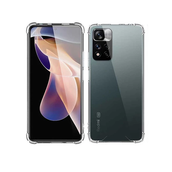 Smcase Xiaomi Redmi Note 11 Pro Kılıf Darbe Korumalı Silikon ürün görseli 1