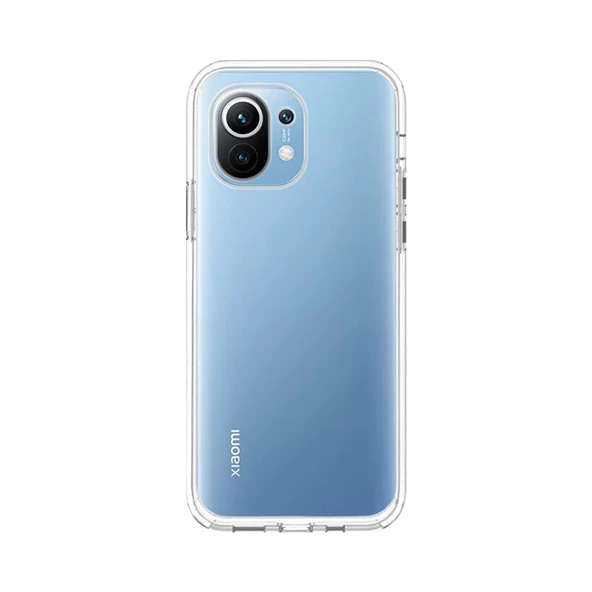 Smcase Xiaomi Mi 11 Kılıf Lüks Lüks Korumalı Tpu Silikon  Tam Kapatan Ekran Koruyucu ürün görseli 1