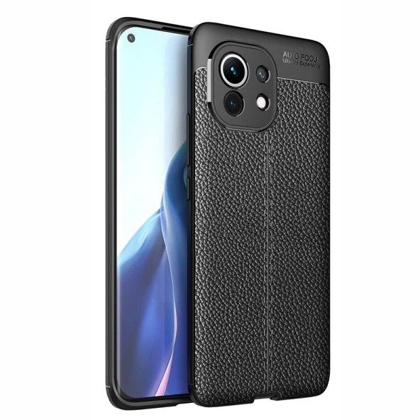 Smcase Xiaomi Mi 11 Kılıf Lüks Kamera Korumalı Deri Dokulu Silikon Tam Kapatan Ekran Koruyucu ürün görseli 1