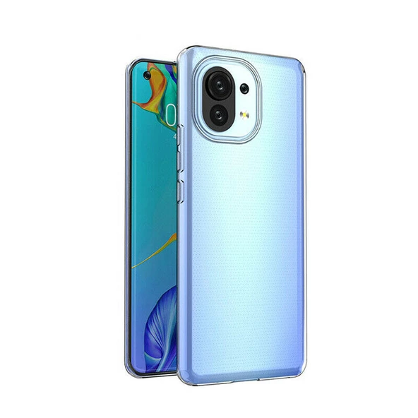 Smcase Xiaomi Mi 11 Lite Kılıf Lüks Korumalı Tpu Silikon  Nano Ekran Koruyucu ürün görseli 1