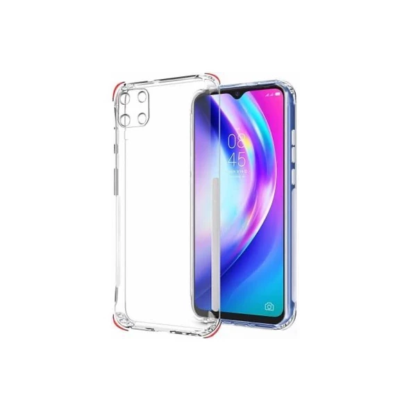 Smcase Samsung Galaxy A81 Kılıf Kamera Korumalı Darbeye Dayanıklı Silikon ürün görseli 1