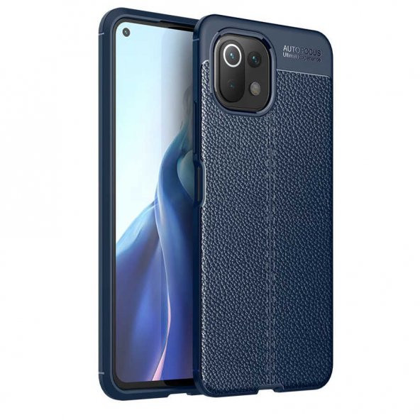 Xiaomi Mi 11 Lite Kılıf Focus Derili Kamera Korumalı Silikon Kılıf ürün görseli 1