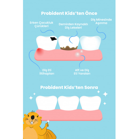 Probident Kids Diş Macunu Şeftali - Resim 2