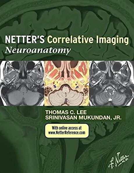 Netter’s Correlative Imaging: Neuroanatomy Thomas C. Lee MD ürün görseli 1