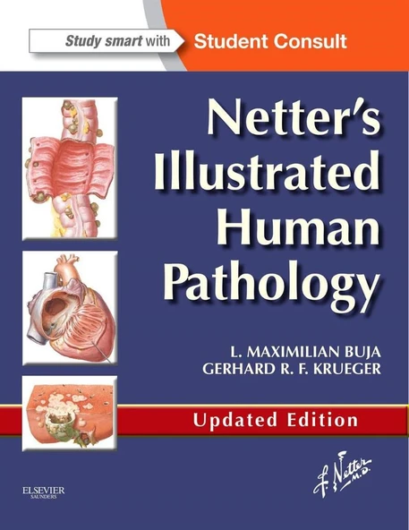 Netter's Illustrated Human Pathology Updated Edition L. Maximilian Buja ürün görseli 1