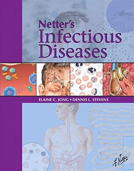 Netter's Infectious Disease Elaine C. Jong MD FIDSA FASTMH ürün görseli 1