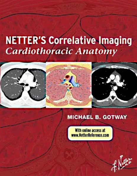 Netter’s Correlative Imaging: Cardiothoracic Anatomy M.D. Gotway, Michael B. ürün görseli 1